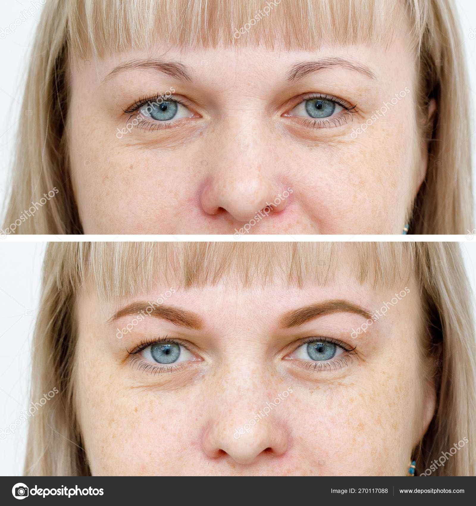 depositphotos_270117088-stock-photo-photo-comparison-before-and-after.jpg