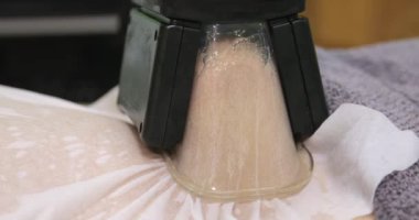 Güzellik veya spa salonunda Cryolipolysis dondurmak yağ prosedürü, göbek yakın çekim