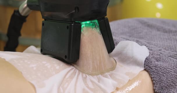 Žena Která Dostává Krásy Nebo Lázeňského Salonu Cryolipolysis Tuk — Stock video