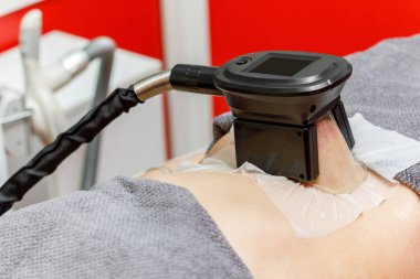 Cryolipolysis yağ dondurma tedavisi. Kilo kaybı ve zayıflama prosedürü