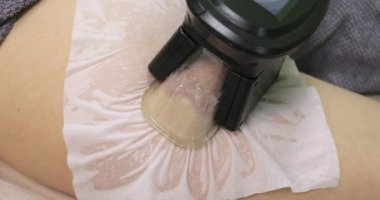 Kadın güzellik veya spa salonunda Cryolipolysis yağ tedavisi alma