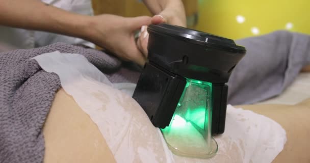 Mulher Recebendo Tratamento Gordura Cryolipolysis Salão Beleza Spa — Vídeo de Stock