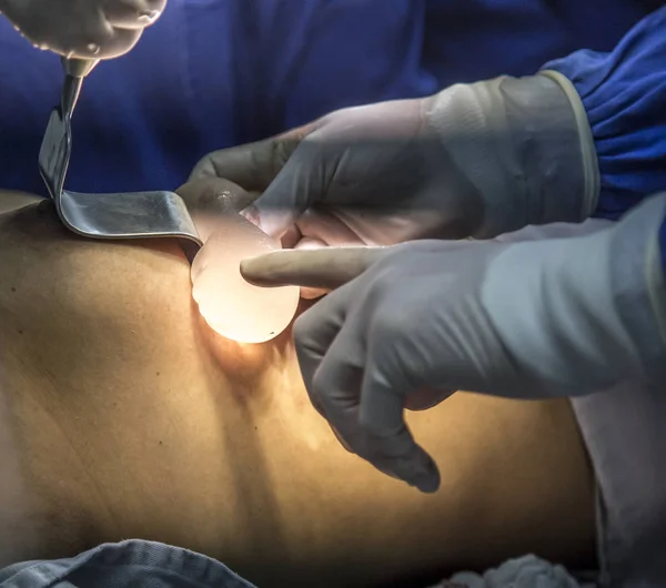 Implante de silicona sutura paciente — Foto de Stock