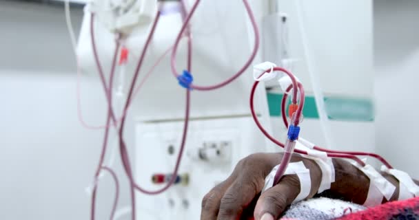 Hémodialyse chez les personnes sur l'équipement — Video