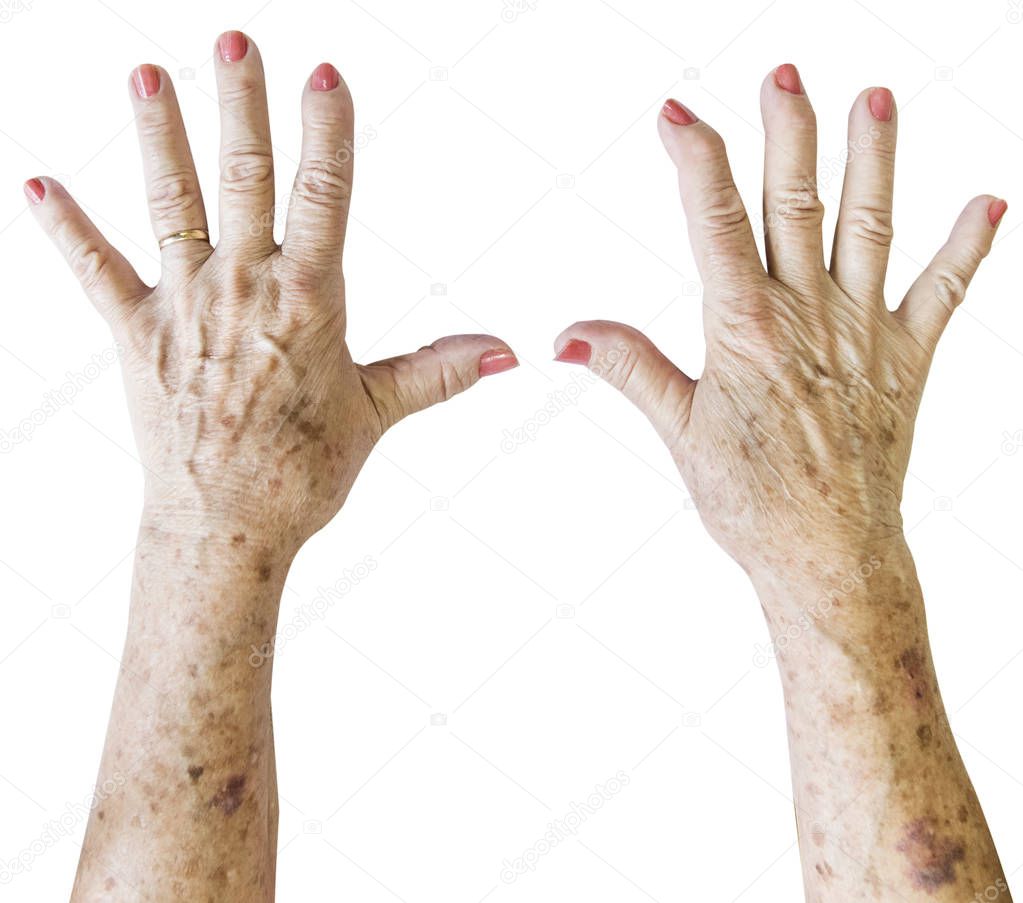 Elderly woman, wrinkled hand palm w/ clearly visible veins reaching out forward. Old lady arms, freckles. Isolated white background