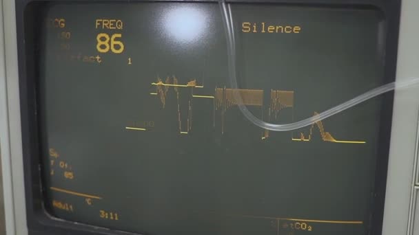 Anzeige von Vitalzeichen und Kardiogramm auf einem Monitor. Gesundheitszustand während der Operation — Stockvideo