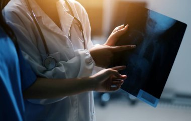 Sağlık, Doktor Teknolojisi, X-Ray Analizi için Tıbbi Ekip Dijital Tablet Kullanıyor.