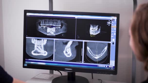 Patient und Arzt betrachten ein Bild der Mundhöhle. Mit Hilfe von Röntgenaufnahmen können Sie die richtige Diagnose stellen und eine Behandlung verschreiben. — Stockvideo