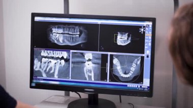 Diş hekimi ve ortodontist, hastanın diş ve çene röntgenlerini monitörde, arkadan görüyor