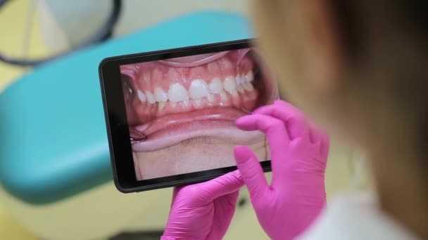 Dentista Mostra Uma Radiografia Paciente Usando Tablet Com Tela Sensível — Vídeo de Stock