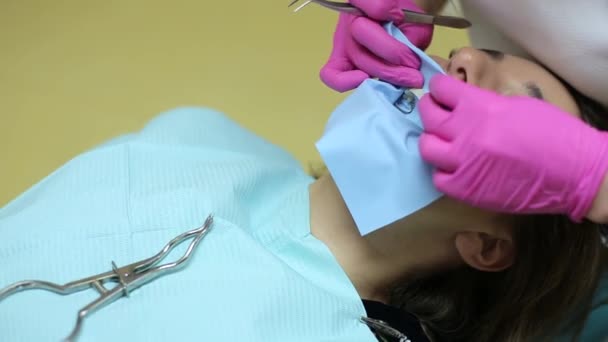 Dentista Sbianca Denti Una Bella Ragazza — Video Stock