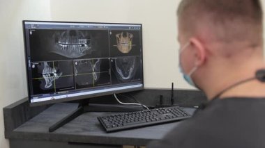 Bir dişçi detaylı tedavi analizi ve planlama stratejileri için bilgisayardaki 3D görüntülemeyi inceliyor