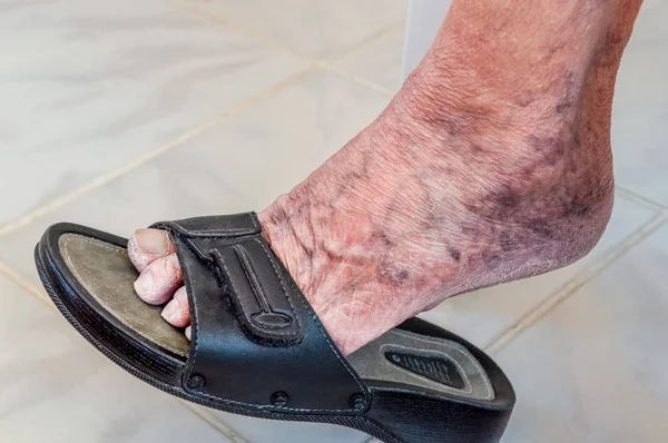 Vecchio piede umano con pantofola nera — Foto Stock
