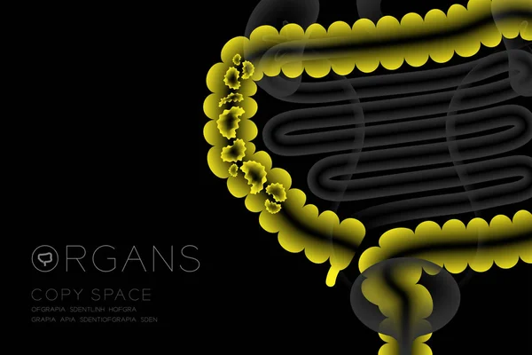 Ανθρώπινα Όργανα Ακτινογραφία Σύνολο Παχύ Έντερο Λοίμωξη Έννοια Ιδέα Κίτρινο — Διανυσματικό Αρχείο