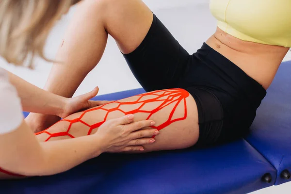 의사는 다리에 방추사 테이프를 붙임으로써 여성을 돕는다 다리에 발근성 신축성 — 스톡 사진