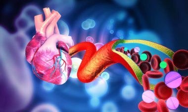 Clogged arteries with human heart. medicine therapy. 3d illustration clipart
