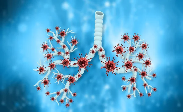 Respiratory Virus Lungs Illustration — Stock Photo, Image