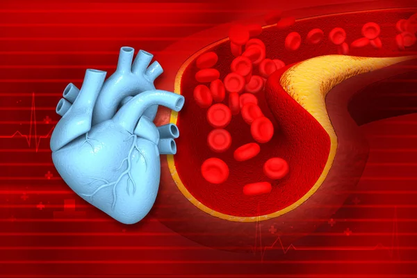 Cholesterol Ucpal Tepnu Lidským Mozkem Ilustrace — Stock fotografie