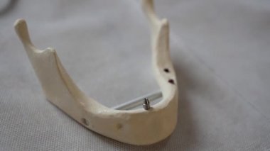 İnsan çene plastik düzen.