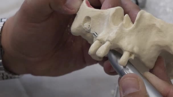 Médico dentista segurando um mock-up de um maxilar humano — Vídeo de Stock