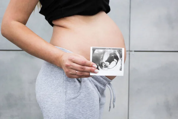 Pregnant woman's belly and ultrasound baby photo close-up. Side view.