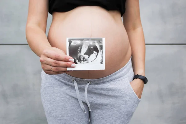 Pregnant woman\'s belly and ultrasound baby photo close-up.