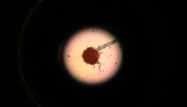 Bir mantarın mikroskoptan görünümü.