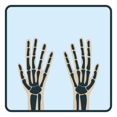 Kol kemiği, x-ışını konsept ikonu, beyaz, düz vektör illüstrasyonunda izole edilmiş insan vücudu. İnsan organizmasının iskelet parçası, siluet siyah biyolojik bilim.