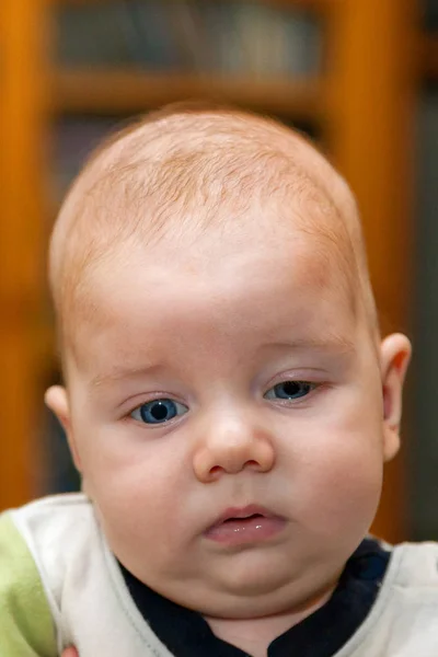 Sol göz rahatsızlığına ve Craniosynostosis olası tanısı ile önden görünüm bir bebek çocuk. Yorgun görünüyor. Bir uzman görmeden önce çözüldü durumu.