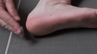 Adam mısır çıkarmadan, bir jilet dosyası kullanarak ayaklarından nasır, erkeksi cilt bakımı, cilt hastalığı, mantar enfeksiyonu, cilt tedavisi