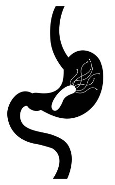 Mide ve bakteri Helicobacter