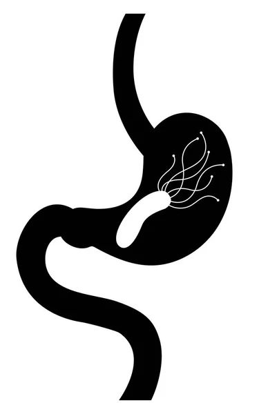 Mide ve bakteri Helicobacter