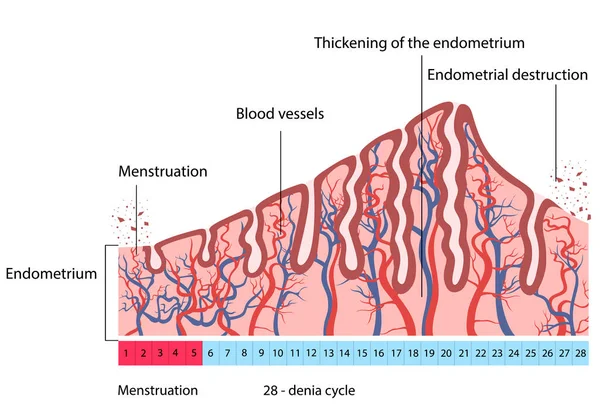 Změny děložní endometriální destrukce Royalty Free Stock Ilustrace