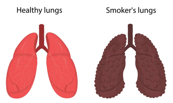 Pulmones y pulmones sanos de fumador — Archivo Imágenes Vectoriales