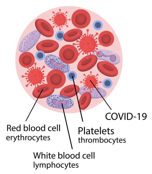 Sangre infectada con coronavirus — Vector de stock