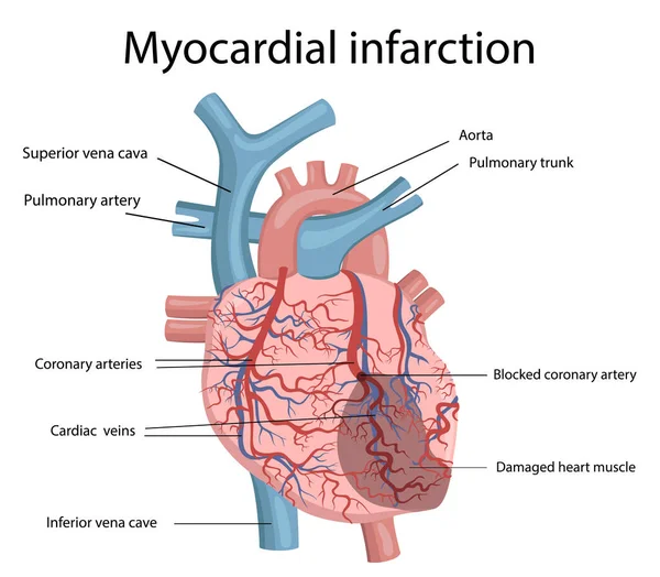 İnsan kalp hastalığı