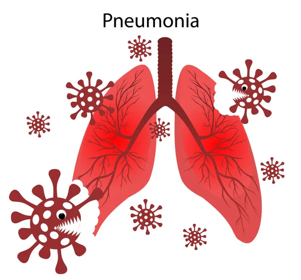 Koronavirüs ciğerleri yer..