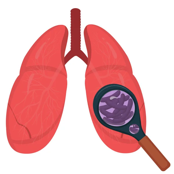 Förstoringsglas och tuberkulos. Strukturen i lungorna — Stock vektor