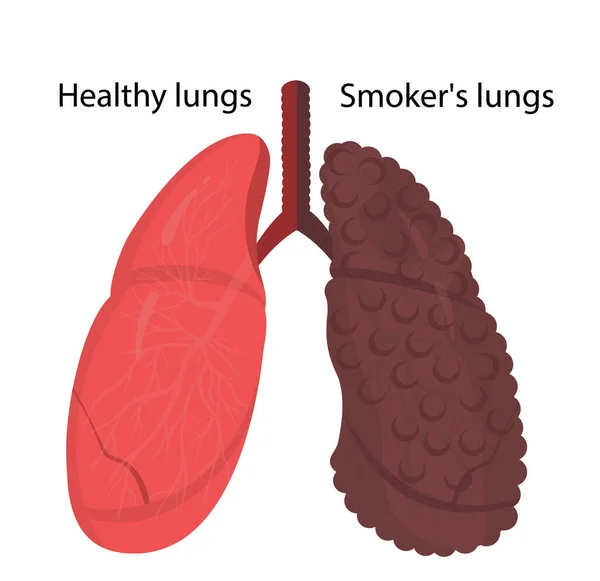 Fumadores pulmones y pulmones sanos — Vector de stock