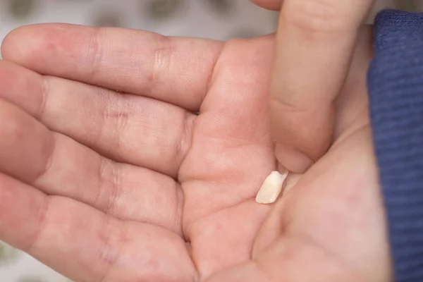 Criança Segura Dente Caído Palma Mão Dente Leite Palma Mão — Fotografia de Stock