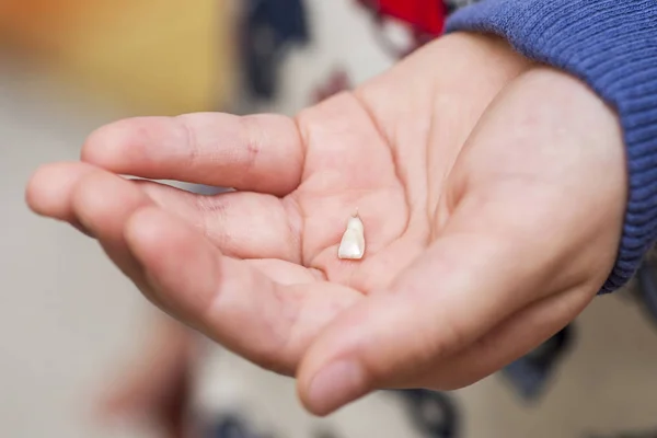 Um miúdo a segurar o primeiro dente de leite perdido. Uma mãozinha com dente solto. Odontologia infantil. Uma criança segurando seu primeiro dente de leite perdido — Fotografia de Stock