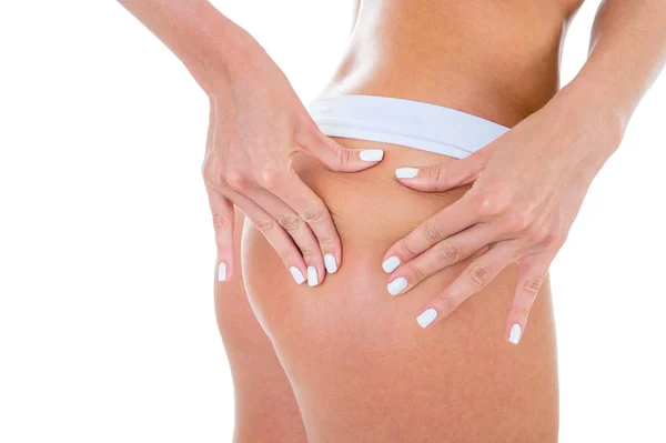 Ellenőrzése Cellulit Csípő Vértes Gyönyörű Női Test Lábak — Stock Fotó