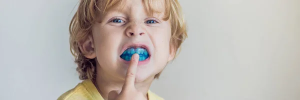 Trzy Letni Chłopiec Wyświetlone Trener Myofunctional Oświetlania Usta Oddech Nawyk — Zdjęcie stockowe