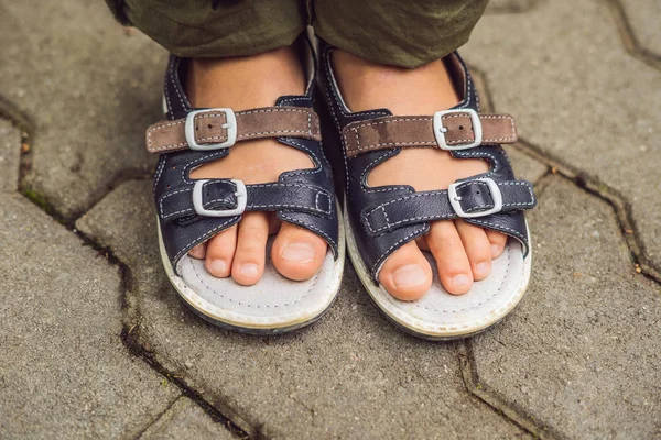 Pies Niño Sandalias Ortopédicas Camino Baldosas — Foto de Stock