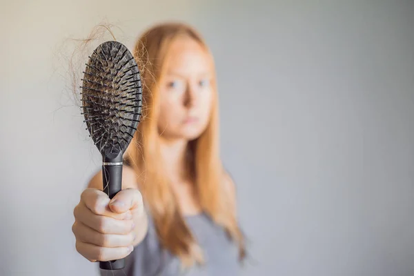 脱发在妇女的概念 梳子上有很多脱发 — 图库照片