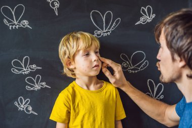 Tebeşir ile küçük çocuk gözümün önünde yazı tahtası üzerinde merhem bulaşması baba sivrisinekler çizilmiş.