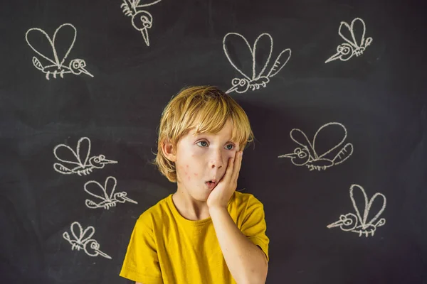 Niño Con Expresión Facial Divertida Picaduras Cara Delante Pizarra Con — Foto de Stock