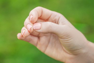 Kırık çiviyle manikür yeşil bir arka plan üzerinde bir womans elde.