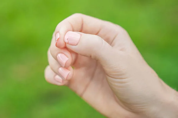 Złamany paznokieć na rękę, womans z manicure na zielonym tle — Zdjęcie stockowe