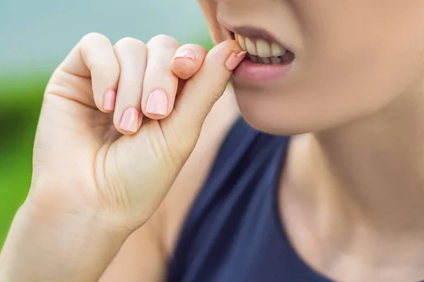 Złamany paznokieć na rękę, womans z manicure na zielonym tle. Kobieta gryzie paznokci — Zdjęcie stockowe